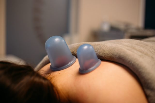 At The Physio Lab, we use a range of hands-on treatments to help you feel and perform your best - including dry needling and cupping therapy.
These treatments can help relieve muscle tightness, improve mobility, reduce pain, and support recovery. 🔥
#thephysiolab #thurles #tipperary #cuppingtherapy #needling
